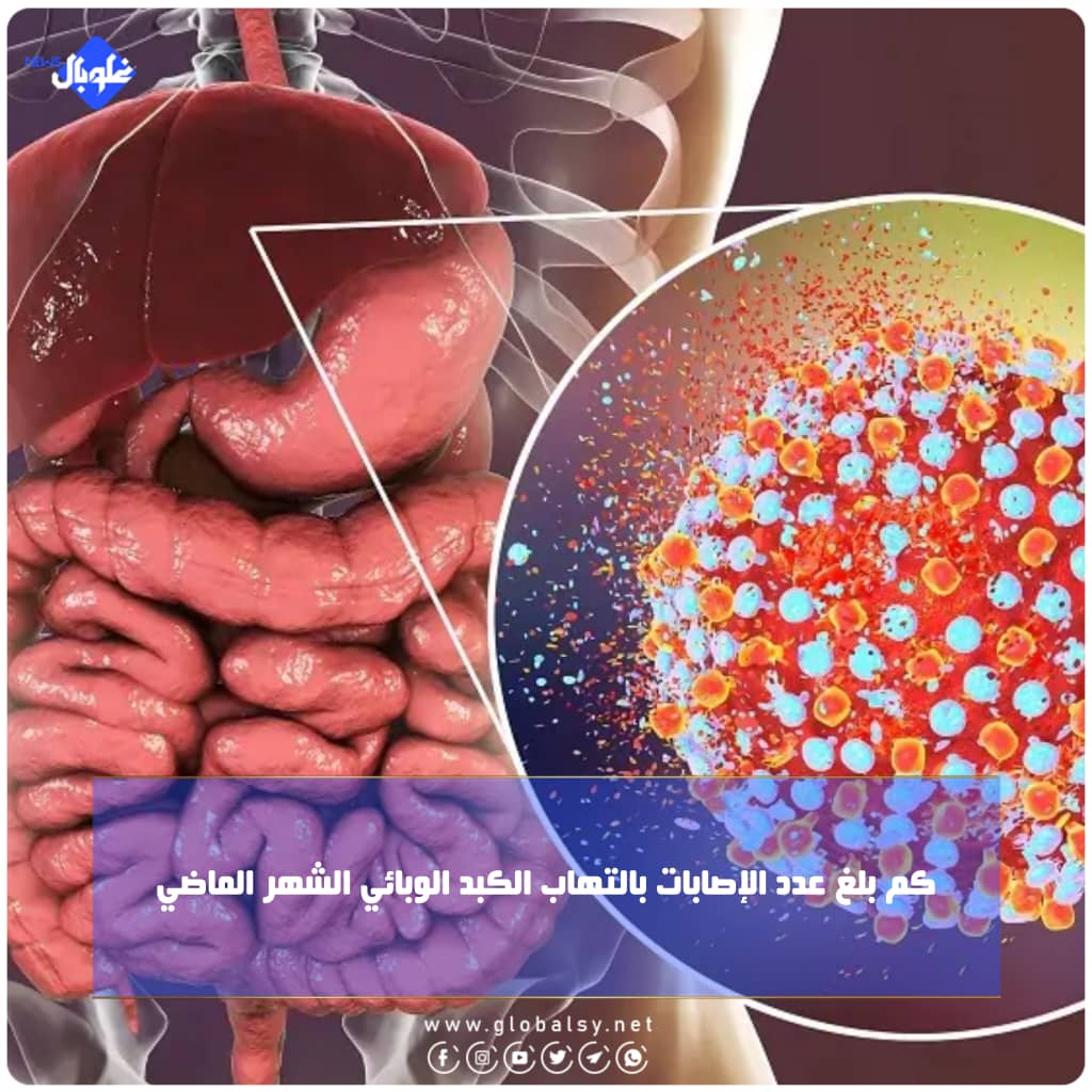 كم بلغ عدد الإصابات بالتهاب الكبد الوبائي الشهر الماضي