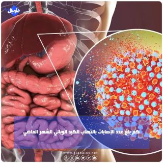 كم بلغ عدد الإصابات بالتهاب الكبد الوبائي الشهر الماضي