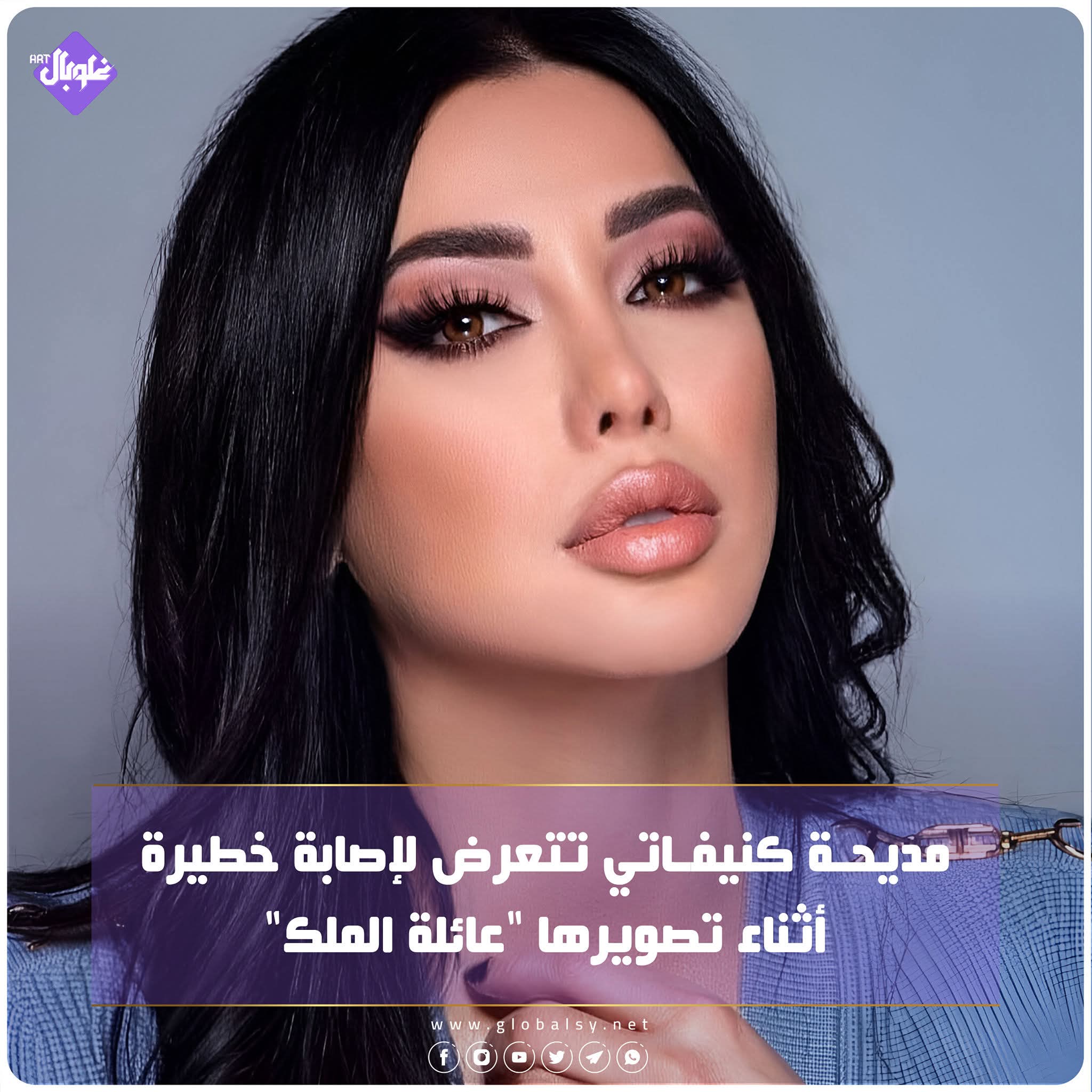 مديحة كنيفاتي تتعرض لإصابة خطيرة أثناء تصويرها "عائلة الملك"