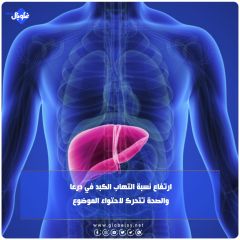 ارتفاع نسبة التهاب الكبد في درعا... والصحة تتحرك لاحتواء الموضوع